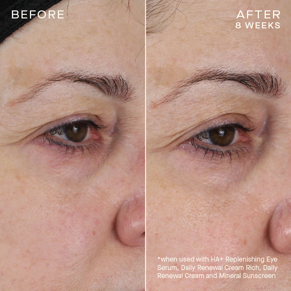Face Firming Duo