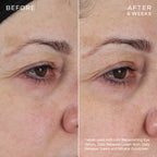 Face Firming Duo