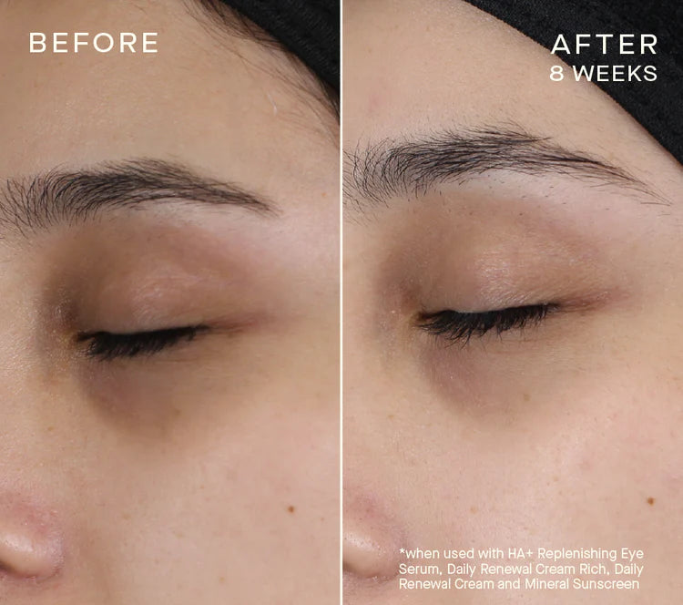 Advanced Regenerative Eye Serum