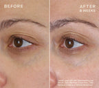 Advanced Regenerative Eye Serum