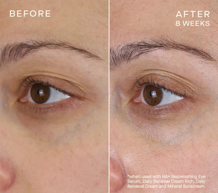Advanced Regenerative Eye Serum